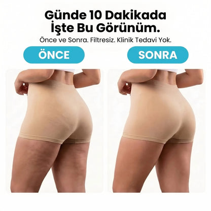 CELVIA SculptRoll™ Selülit Masaj Aleti - Pürüzsüz & Sıkı Görünüm